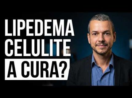 CELULITE e LIPEDEMA tem cura? Pare de Fazer Isso Hoje!